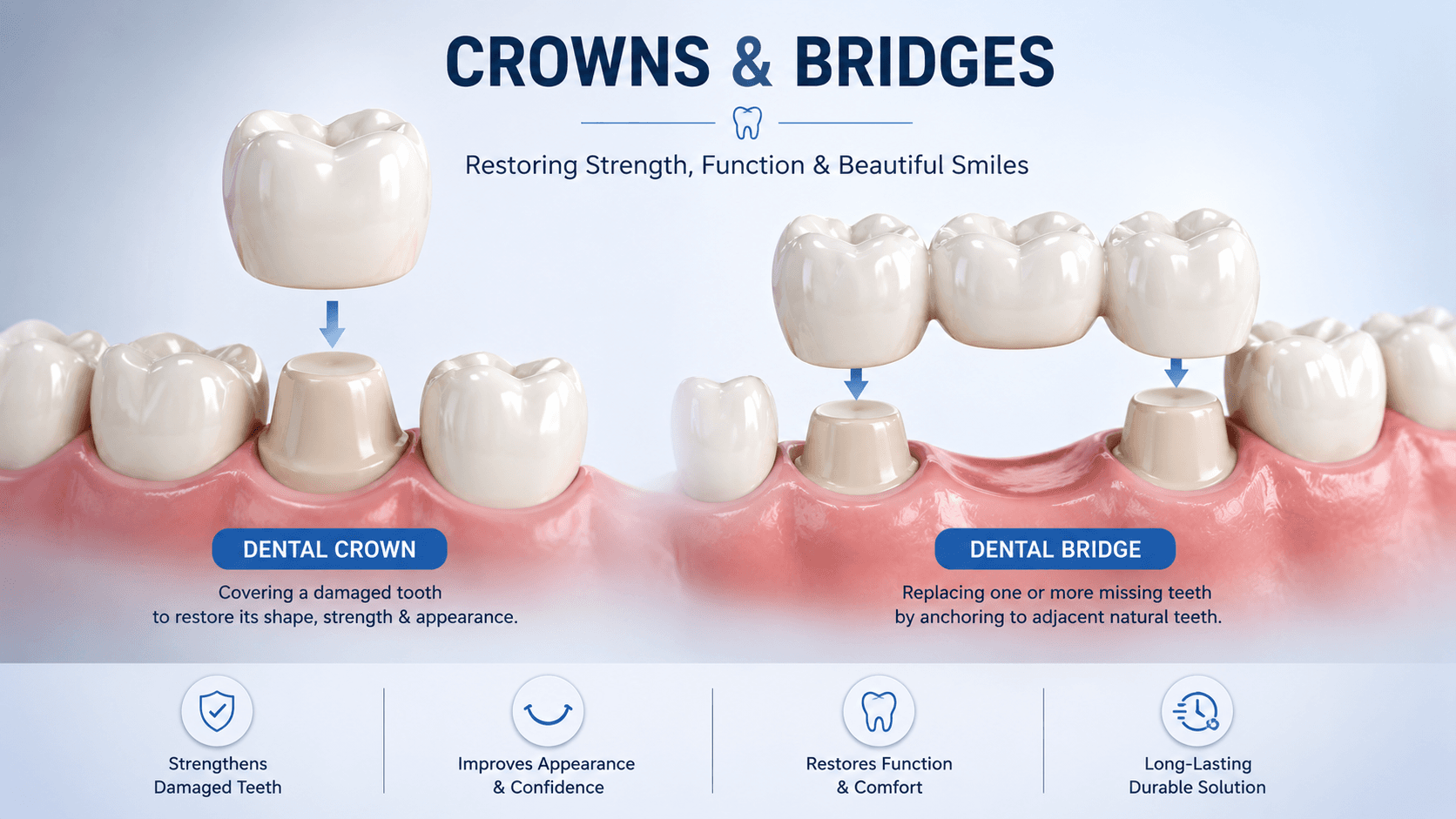 Crowns and Bridges